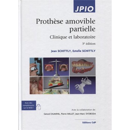 Prothèse amovible partielle