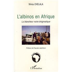 L'albinos en Afrique