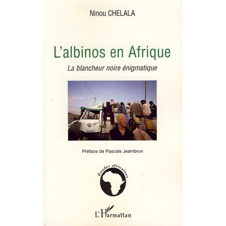 L'albinos en Afrique