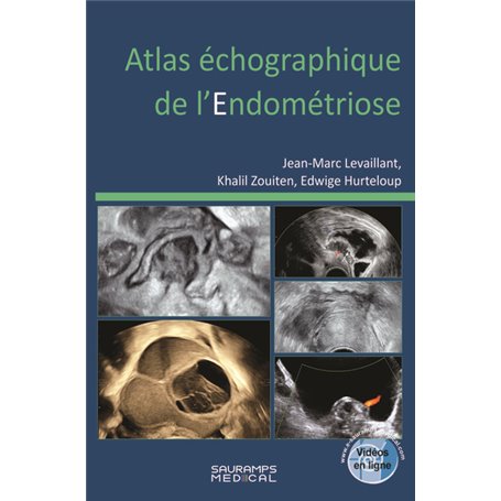 Atlas échographique de l'endométriose