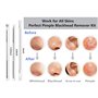 Extracteur d'acné dissolvant de points noirs Acier Inoxydable Outil D’extracteur de Point Noir Professionnel Tire Comédons Acné 