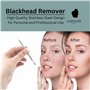 Glamified, glam Extracteur de points noirs professionnel pour soins de la peau, outil de retrait des points noirs pour les imper