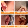 Cozlly Correcteur d'oreille, 4x50CM Patch de Correction d'oreille en Silicone, Patch de Correction D'oreillette Valgus pour Bébé