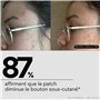 Skin & Out - Patchs Micro-aiguilles x9 - Stop boutons - Traitement des boutons - Réduction rapide de l'inflamation sous-cutanée 