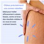 Masseur Anti-Cellulite et Vergetures 2-en-1 | Drainage Lymphatique et Palper-Rouler | Élimine Cellulite et Réduit Vergetures | S