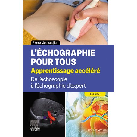L'échographie pour tous : apprentissage accéléré