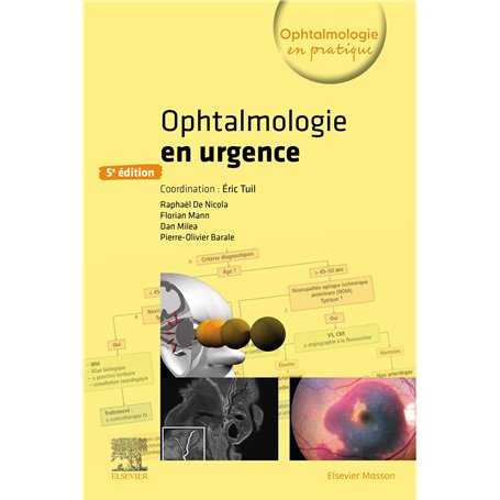 Ophtalmologie en urgence