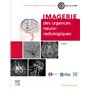 Imagerie des urgences neuroradiologiques