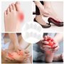 4 Pièces Blanc Séparateur d'Orteils en Silicone Souple,pour Hallux Valgus,Correcteur d'Oignons et Orteils en Marteau,Instantané 
