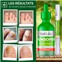 NAIL LAB Traitement Fongique Premium pour Ongles de Pied Extra Fort - 50ml - Contient de l'Huile d'Arbre à Thé, Mycose des Ongle