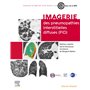Imagerie des pneumopathies interstitielles diffuses (PID) 74,36 €
