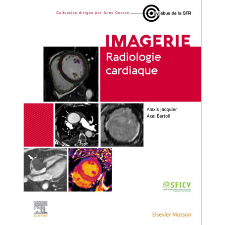 Radiologie cardiaque
