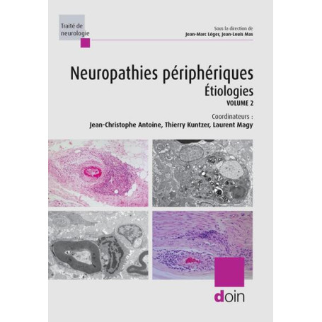 Neuropathies périphériques. Volume 2 : Etiologies