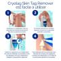 Cryotag Skin Tag Remover Traitement Acrochordons - Rapide Efficace Sûr - Élimine les acrochordons par cryothérapie à partir d'un