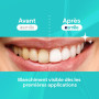 EASY SMILE – Recharge Professionnelle de Blanchiment Dentaire – 3 Stylos de Gel Blanchissant – Blanchiment Rapide et Efficace, É