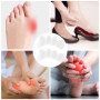 4 Pièces Blanc Séparateur d'Orteils en Silicone Souple,pour Hallux Valgus,Correcteur d'Oignons et Orteils en Marteau,Instantané 