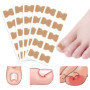 Lot de 50 patchs de correction des ongles incarnés sans colle pour ongles d'orteils pour soins des pieds, autocollants de correc