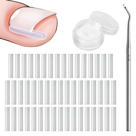 WOLMIK Lot de 40 correcteurs d'ongles incarnés sans douleur avec rehausseur d'ongles incarnés - Kit d'outils faciles à utiliser
