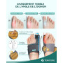 TENICORE Amélioré Hallux Valgus Correcteur avec 2 Barres d'angle，Orthese Hallux Valgus avec Coussin en Silicone Soulagement des 