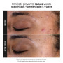 Paula's Choice SKIN PERFECTING 2% BHA Lotion Exfoliante - Gommage Visage avec Acide Salicylique - Réduire les Points Noirs & Por