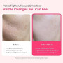 Dr.Melaxin Cyano Pink Spicule Serum avec vitamine B12, traitement visage liquide à micro-aiguilles pour pores dilatés (Cyano Pin