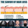 Pousse Cheveux Très Rapide, Serum Cheveux, Anti-chute de Cheveuxs pour Hommes, Favorise une Croissance Plus Epaisse des cheveuxs