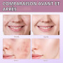 2pcs Calcium Volume Multi Balm Stick Collagene Coreen Stick Anti Rides Coréen Elle Combine Des Propriétés Hydratantes Raffermiss