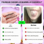 CASSIECA 12Pcs 14G Piercing Teton et Langue pour Femme en Acier Chirurgical - Barbells Argent Bijoux Mamelon